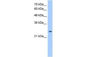 PRDX6 antibody used at 1. (Peroxiredoxin 6 抗体  (Middle Region))