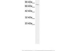 Image no. 2 for anti-Endoglin (ENG) (AA 61-110) antibody (ABIN202837) (Endoglin 抗体  (AA 61-110))