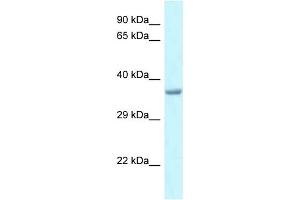 WB Suggested Anti-Pitx1 Antibody   Titration: 1. (PITX1 抗体  (Middle Region))