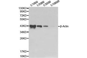 Western blot analysis of HeLa cell using β-actin antibody at different dilutions. (beta Actin 抗体)