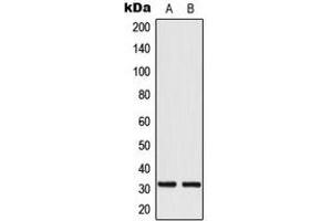 Western blot analysis of MRPL24 expression in HeLa (A), HepG2 (B) whole cell lysates. (MRPL24 抗体  (Center))