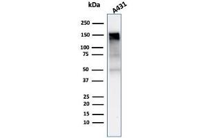 Western Blot Analysis of A431 cell lysate using EGFR-Monospecific Mouse Monoclonal Antibody (rGFR/1667). (Recombinant EGFR 抗体)