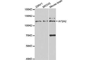 Western blot analysis of extracts of various cell lines, using AP2A2 antibody (ABIN5973124) at 1/1000 dilution. (AP2A2 抗体)