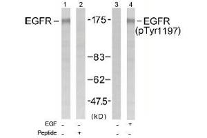 Image no. 1 for anti-Epidermal Growth Factor Receptor (EGFR) (Tyr1197) antibody (ABIN197462) (EGFR 抗体  (Tyr1197))