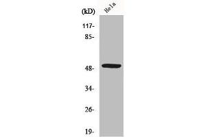 Western Blot analysis of Jurkat cells using MYLIP Polyclonal Antibody (MYLIP 抗体  (Internal Region))