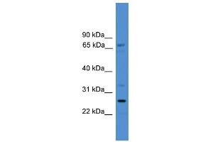 WB Suggested Anti-SLC13A3 Antibody Titration:  0. (SLC13A3 抗体  (C-Term))