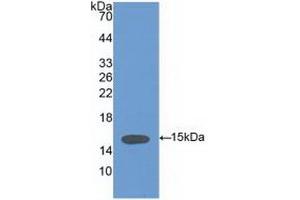 Detection of Recombinant VCL, Human using Polyclonal Antibody to Vinculin (VCL) (Vinculin 抗体  (AA 1020-1134))