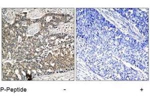 Image no. 3 for anti-DOK2 (DOK2) (pTyr299) antibody (ABIN197044) (DOK2 抗体  (pTyr299))