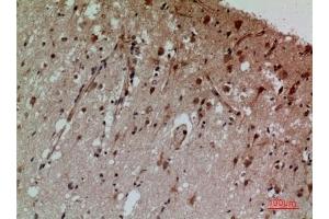 Immunohistochemical analysis of paraffin-embedded human-brain, antibody was diluted at 1:100. (CD58 抗体  (Internal Region))