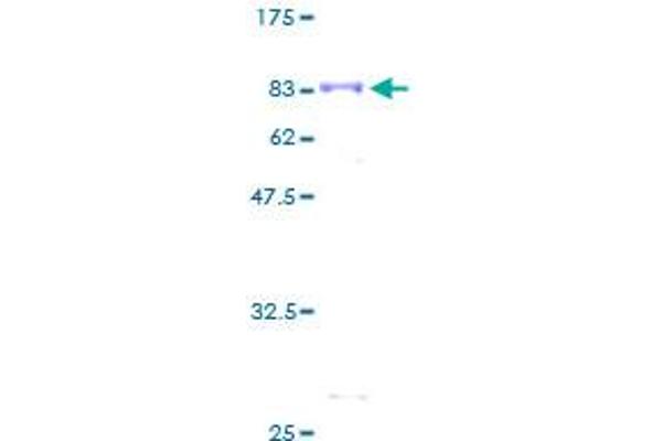 SGK1 Protein (AA 1-431) (GST tag)