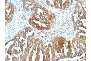 Image no. 2 for anti-Vascular Endothelial Growth Factor A (VEGFA) antibody (ABIN6168158) (VEGFA 抗体)