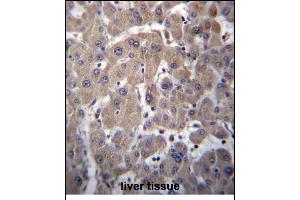 YIPF1 Antibody (N-term) (ABIN656786 and ABIN2846004) immunohistochemistry analysis in formalin fixed and paraffin embedded human liver tissue followed by peroxidase conjugation of the secondary antibody and DAB staining. (YIPF1 抗体  (N-Term))