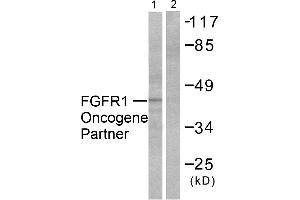 Western blot analysis of extracts from HepG2 cells, using FGFR1 Oncogene Partner antibody (#C0190). (FGFR1OP 抗体)