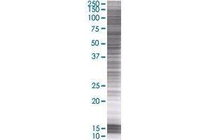 AURKC transfected lysate. (AURKC 293T Cell Transient Overexpression Lysate(Denatured))