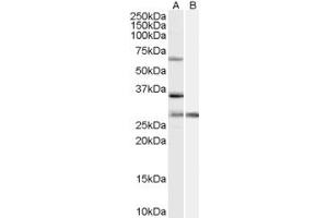 Western Blotting (WB) image for anti-Pre-mRNA Processing Factor 31 (PRPF31) (Internal Region) antibody (ABIN2466149) (PRPF31 抗体  (Internal Region))
