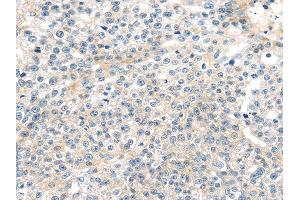 Immunohistochemistry (IHC) image for anti-Tumor Necrosis Factor, alpha-Induced Protein 8 (TNFAIP8) antibody (ABIN5958018) (TNFAIP8 抗体)