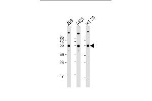 All lanes : Anti-TP53 Antibody (C-term) at 1:2000 dilution Lane 1: 293 whole cell lysate Lane 2: A431 whole cell lysate Lane 3: HT-29 whole cell lysate Lysates/proteins at 20 μg per lane. (p53 抗体  (C-Term))