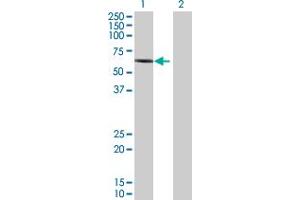Western Blot analysis of RIPK2 expression in transfected 293T cell line by RIPK2 MaxPab polyclonal antibody. (RIPK2 抗体  (AA 1-540))