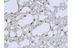 Immunohistochemistry (IHC) image for anti-Interleukin 1, beta (IL1B) (AA 101-200) antibody (ABIN728503)