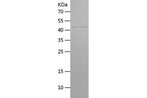 Western Blotting (WB) image for Follicle Stimulating Hormone Receptor (FSHR) (AA 35-240) protein (His-IF2DI Tag) (ABIN7122985) (FSHR Protein (AA 35-240) (His-IF2DI Tag))