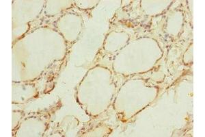 Immunohistochemistry of paraffin-embedded human thyroid tissue using ABIN7159887 at dilution of 1:100 (TIMM1B (AA 1-103) 抗体)