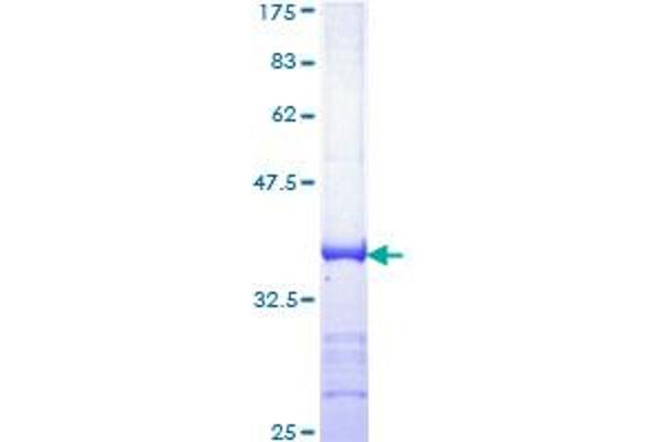 ATR Protein (AA 2545-2644) (GST tag)