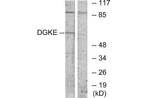 Western Blotting (WB) image for anti-Diacylglycerol Kinase, epsilon 64kDa (DGKE) (Internal Region) antibody (ABIN1849433) (DGKE 抗体  (Internal Region))