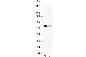 Western blot testing of KLF8 antibody and Lane 1:  SMMC-7721;  2: 293T cell lysate. (KLF8 抗体  (N-Term))