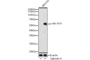 Western blot analysis of extracts of NIH/3T3 cells, using Phospho-Akt-S473 antibody (ABIN7265522) at 1:1000 dilution. (AKT 1/2/3 抗体  (pSer472))