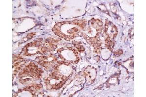 Immunohistochemistry (Paraffin-embedded Sections) (IHC (p)) image for anti-V-Set Domain Containing T Cell Activation Inhibitor 1 (VTCN1) (AA 50-100) antibody (ABIN671736)