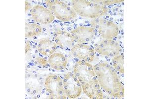 Immunohistochemistry of paraffin-embedded mouse kidney using ADIPOQ Antibody (ABIN5971370) at dilution of 1/100 (40x lens). (ADIPOQ 抗体)