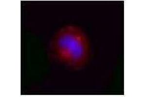 Immunofluorescence (IF) image for anti-Valosin Containing Protein (VCP) antibody (ABIN2666418) (VCP 抗体)