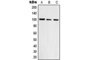 Western blot analysis of Topoisomerase 3 beta1 expression in HepG2 (A), A431 (B), HeLa (C) whole cell lysates. (Topoisomerase 3 Beta1 (N-Term) 抗体)
