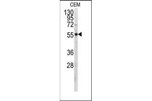 Western blot analysis of anti-PKM2 Antibody (C-term) in CEM cell line lysates (35ug/lane). (PKM2 抗体  (C-Term))
