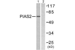 Western Blotting (WB) image for anti-Protein Inhibitor of Activated STAT, 2 (PIAS2) (N-Term) antibody (ABIN1848834) (PIAS2 抗体  (N-Term))