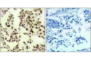 Immunohistochemistry (IHC) image for anti-Tumor Protein P73 (TP73) (pTyr99) antibody (ABIN2888508) (Tumor Protein p73 抗体  (pTyr99))