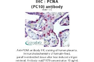 Image no. 1 for anti-Proliferating Cell Nuclear Antigen (PCNA) antibody (ABIN1724017) (PCNA 抗体)