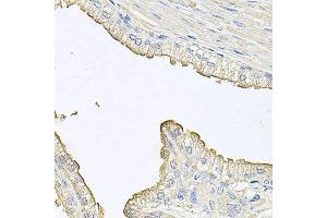 Immunohistochemistry of paraffin-embedded human prostate using FABP12 antibody at dilution of 1:100 (x40 lens). (FABP12 抗体)