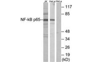 Western blot analysis of extracts from Jurkat/HeLa, using NF-kappaB p65 (Ab-529) Antibody. (NF-kB p65 抗体  (AA 496-545))