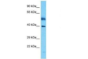 Host:  Rabbit  Target Name:  IRF1  Sample Tissue:  Human Esophagus Tumor  Antibody Dilution:  1ug/ml (IRF1 抗体  (Middle Region))