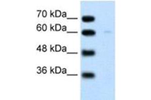 Western Blotting (WB) image for anti-Regulator of G-Protein Signaling 4 (RGS4) antibody (ABIN2460183) (RGS4 抗体)