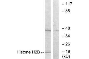 Western Blotting (WB) image for anti-Histone H2B (N-Term) antibody (ABIN1849874) (Histone H2B 抗体  (N-Term))