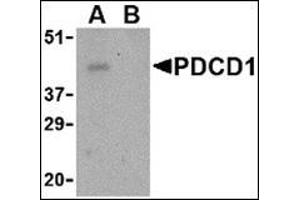 Western blot analysis of PD-1 in THP-1 cell lysate with this product at 1 μg/ml in the (A) absence and (B) presence of blocking peptide. (PD-1 抗体  (Center))