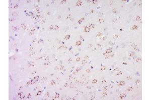 Paraformaldehyde-fixed, paraffin embedded rat brain, Antigen retrieval by boiling in sodium citrate buffer (pH6) for 15min, Block endogenous peroxidase by 3% hydrogen peroxide for 30 minutes, Blocking buffer (normal goat serum) at 37°C for 20min, Antibody incubation with PAS1C1 Polyclonal Antibody, Unconjugated  at 1:500 overnight at 4°C, followed by a conjugated secondary and DAB staining (PAS1C1 抗体)