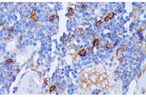 Immunohistochemistry of paraffin-embedded Rat bone marrow using PADI4 Polyclonal Antibody at dilution of 1:100 (40x lens). (PAD4 抗体)