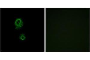 Immunofluorescence analysis of A549 cells, using MRGRG Antibody. (Mrgprg 抗体  (AA 231-280))