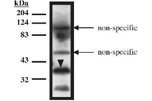 Western blot analysis using TUP1 antibody on recombinant TUP1 protein (amino acids 1-200) expressed in Mav108 cells. (HIRA 抗体)