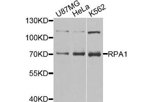Western blot analysis of extracts of various cell lines,using RPA1 antibody. (RPA1 抗体)