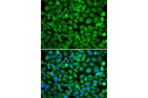 Immunofluorescence analysis of MCF-7 cells using SAT2 antibody. (SAT2 抗体)