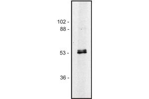 Western blot of human Jurkat T cell line (Alpha, beta-Tubulin Dimer 抗体)